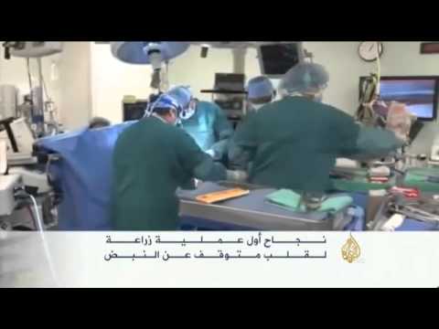 نجاح أول عملية زراعة قلب متوقف عن النبض