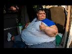 onetime worlds heaviest man has second surgery