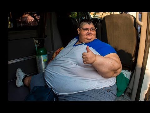 onetime worlds heaviest man has second surgery